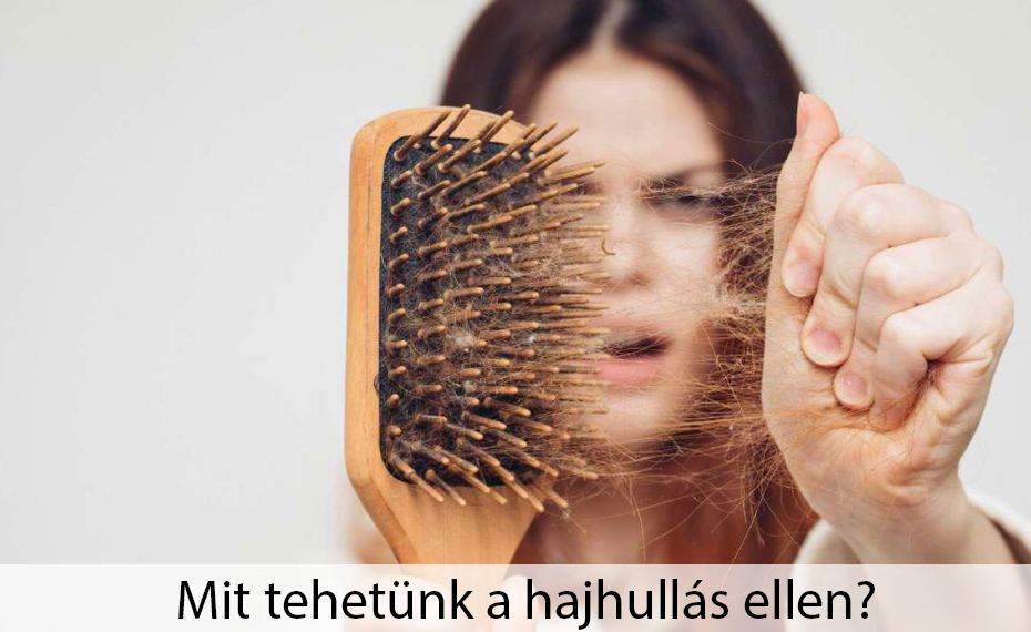 A hajhullás okai?! Mit tehetünk a hajhullás ellen?